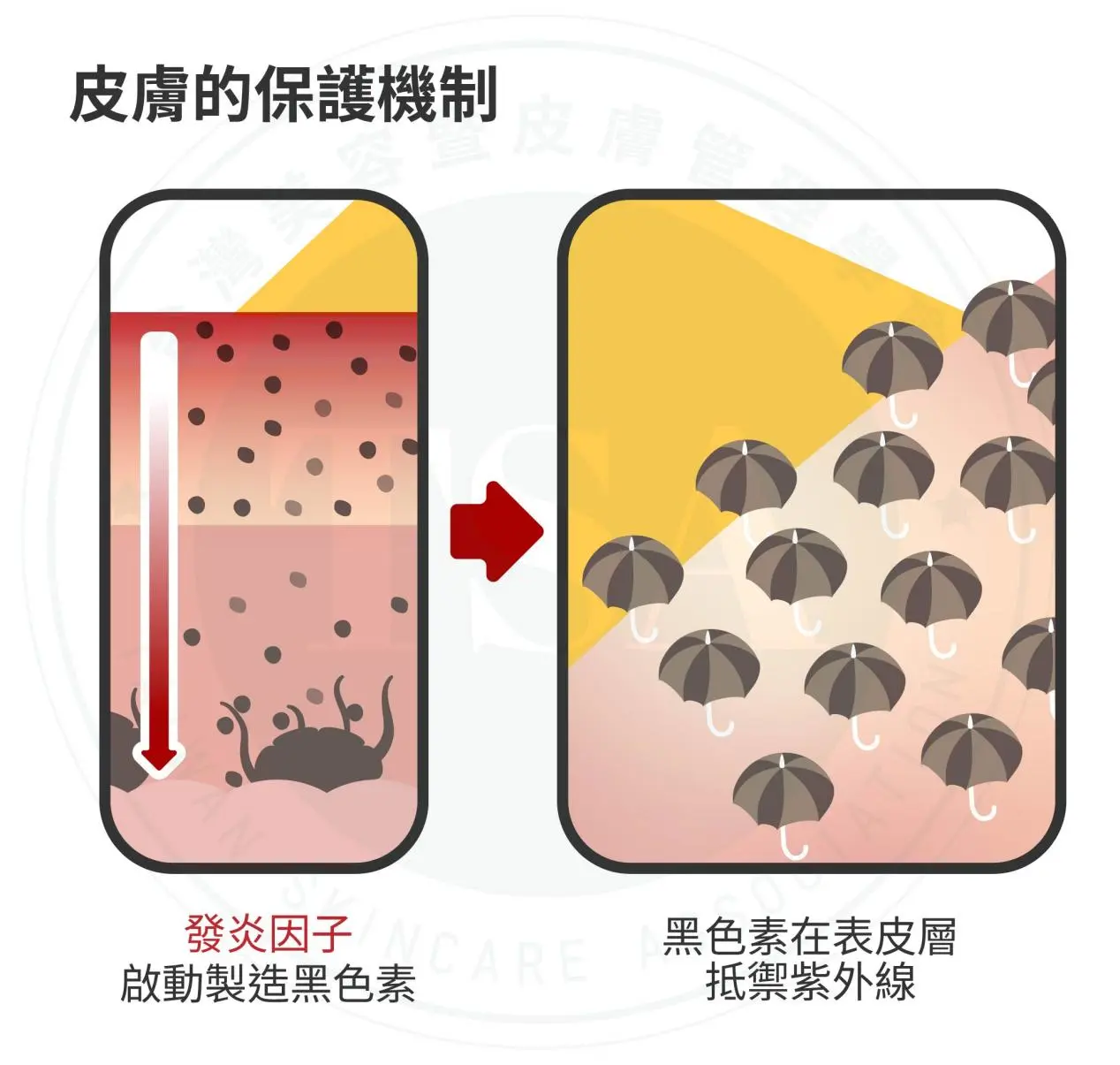 曬後敏感 皮膚的保護機制